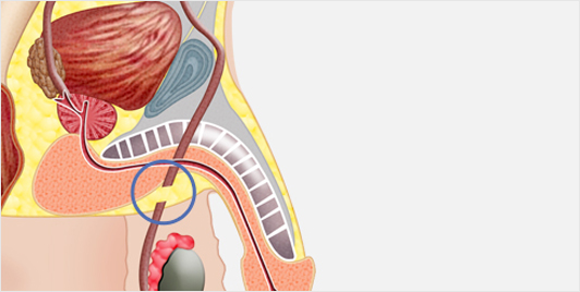 Satisfactory Results, Fast Recovery